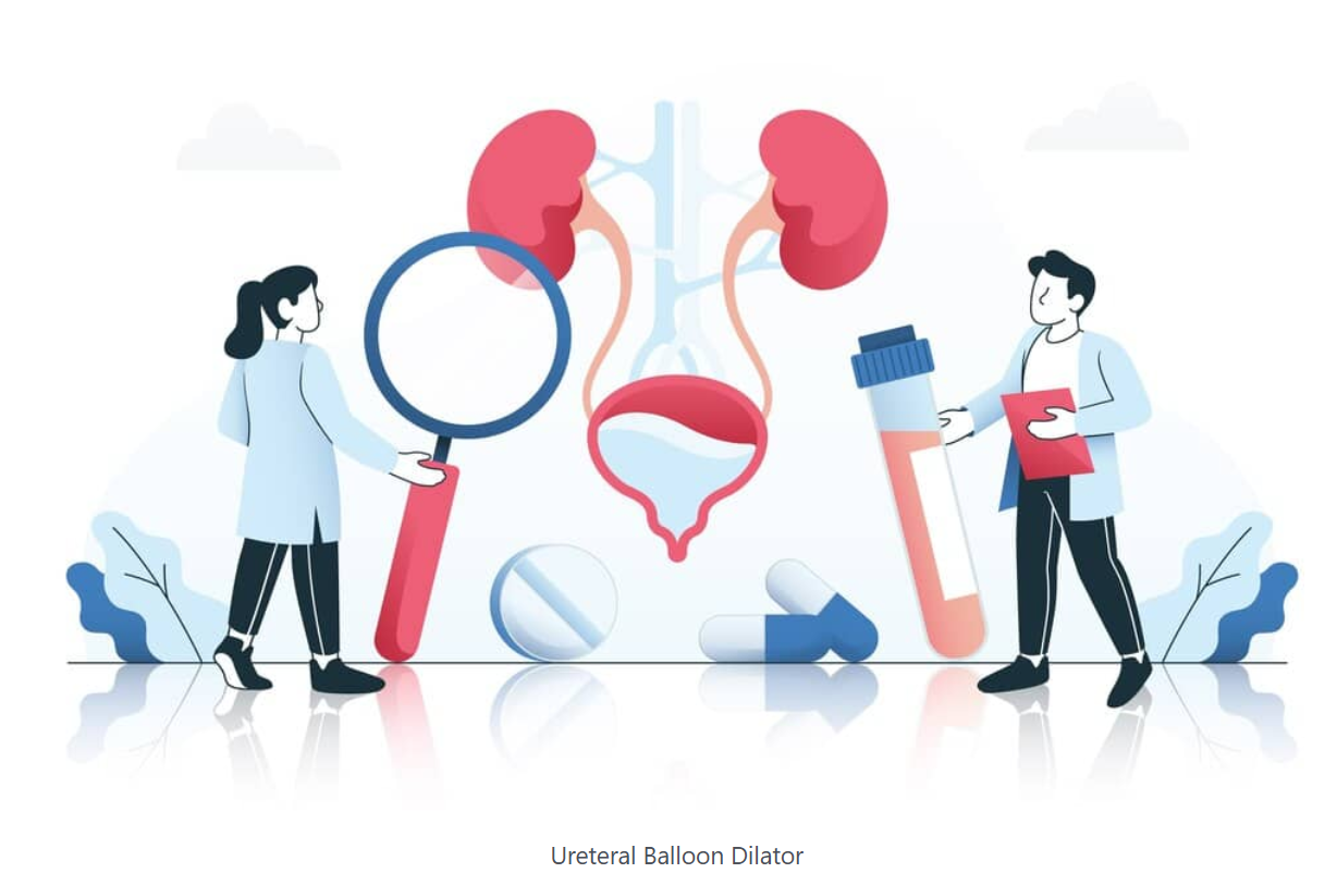 Introduction to Ureteral Dilator Set